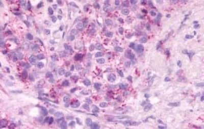 Immunohistochemistry-Paraffin: S1P2/EDG-5/S1PR2 Antibody [NBP3-14466]